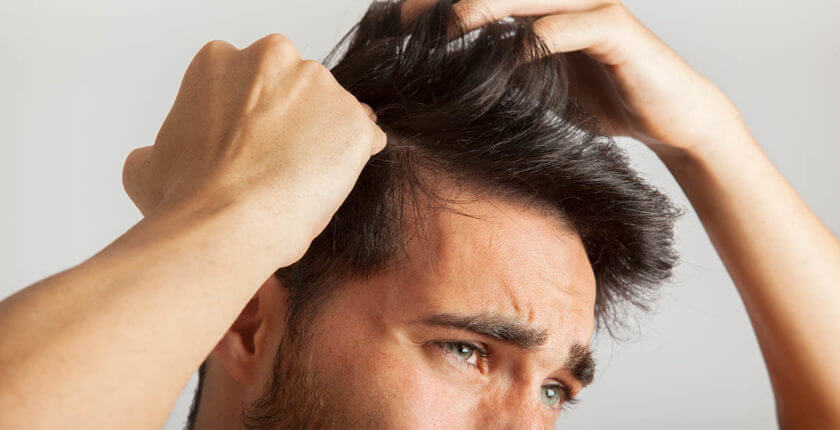 COVID-19: ¿pérdida de cabello por estrés o calvicie?